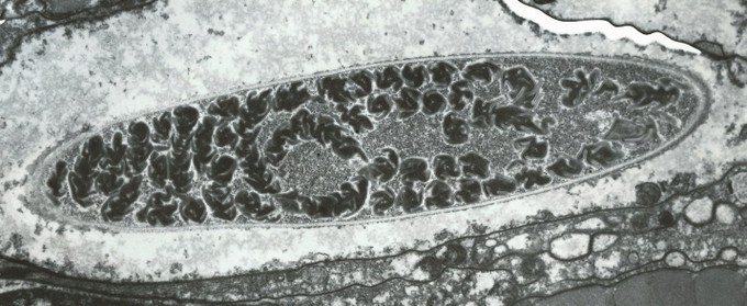 ساختار یک cnidocyte مرجان برای گرفتن طعمه